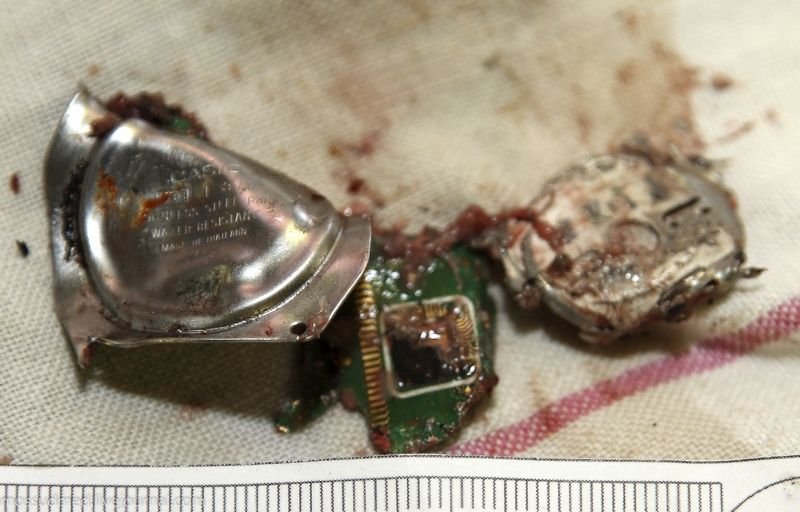 Последствия взрывов на «Парке культуре»: деформированный корпус от наручных часов, который обнаружили в ткани мозга - фото 30 из книги «Вскрытие покажет»