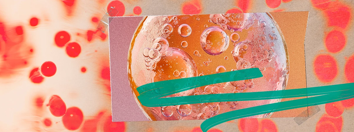 9 мифов про ЭКО