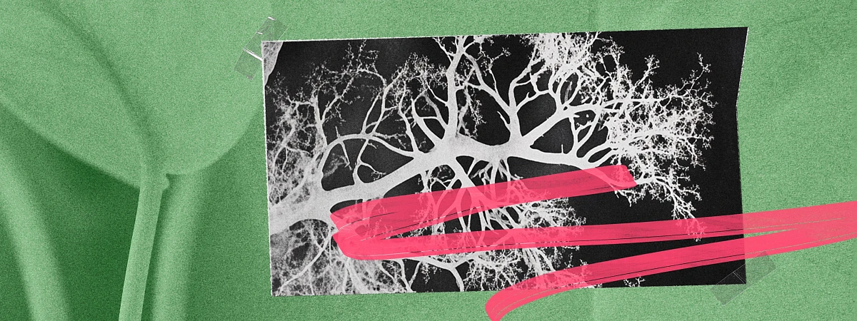 Попрощайтесь с отеками: 5 простых способов поддержать лимфатическую систему