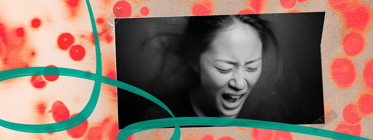 Главные вопросы про аллергию: как не убить гостя за обеденным столом и можно ли заразиться экземой